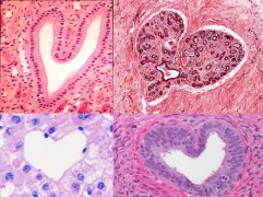 My collage, I will wear my heart upon my sleeve